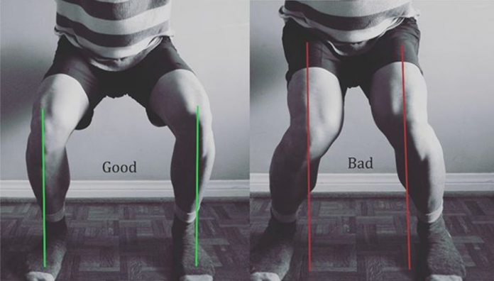 Squatting and Knee Cave